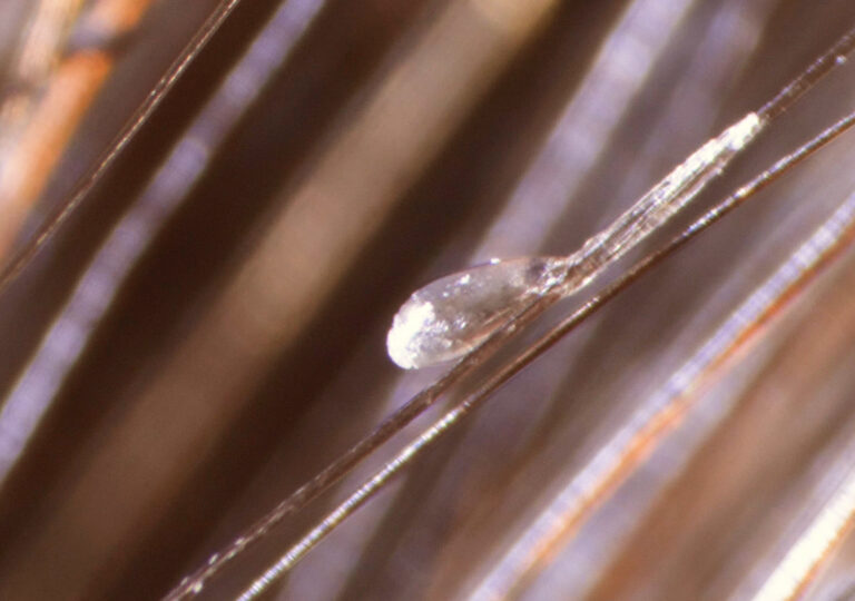 Pricing & Services Torrance Lice Removal